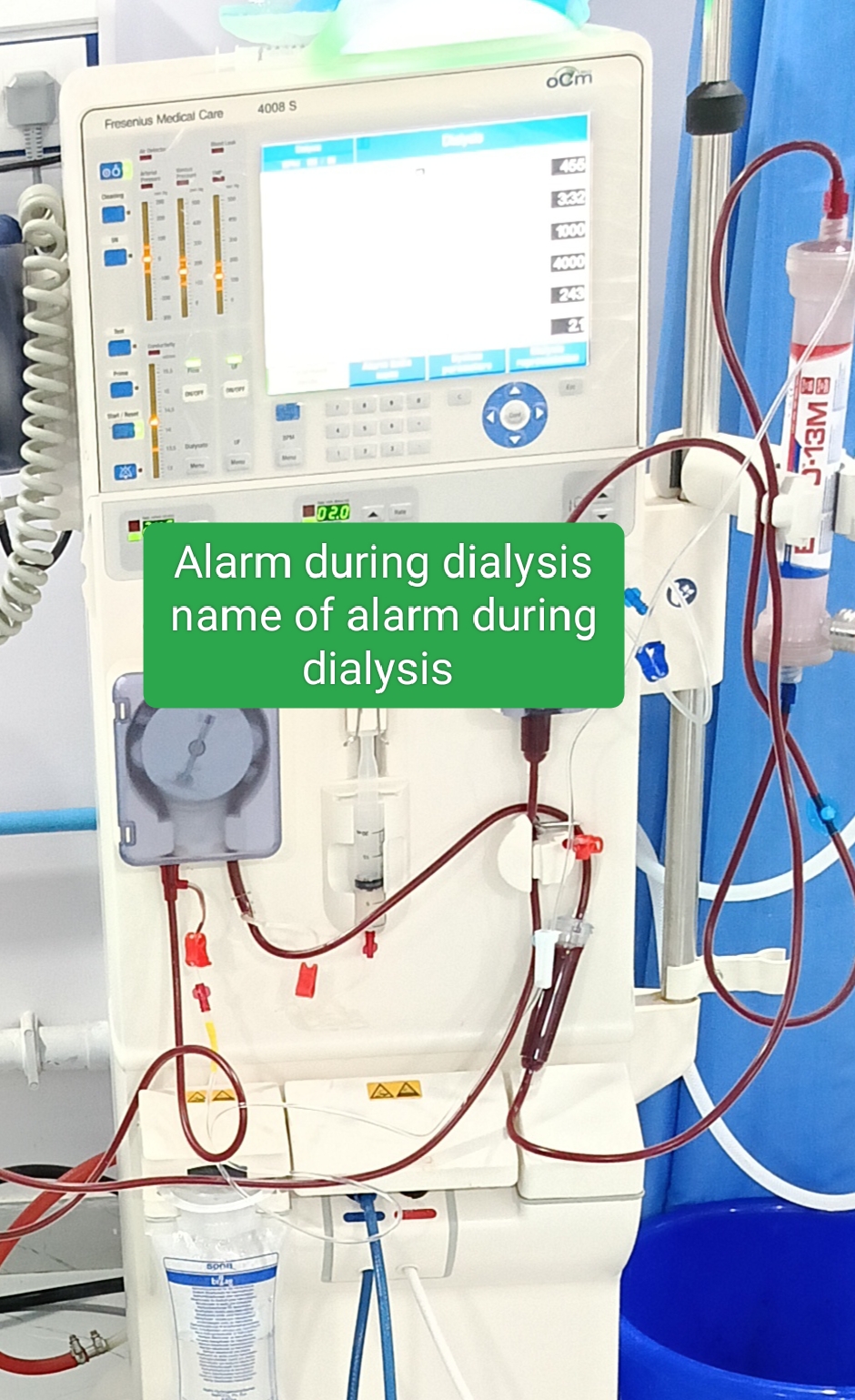 dialysis whats is dialysis dialysis defination