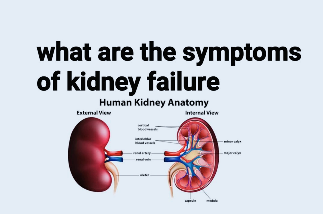 what is kidney failure symptoms what are the symptoms of kidney failure Symptoms of kidney failure 3 Most comman & Problem for kidney failure most common kidney fallure problem name and symptoms Ist_ __ High blood pressure means un control blood pressure (Hypertension) 2nd___High Sugar (Hyperglycemia) uncontrolle Sugar 3rd: 1st and 2nd symptoms men's both are hypertension & hyperglycemia 4th long term infection any part of body 5Th: family history of kidney failure 6th: Allergic reaction, skin infection, What are the first signs of kidney problems? Symptoms can include: weight loss and poor appetite. swollen ankles, feet or hands as a result of water retention (oedema)shortness of breath. tiredness. blood in your pee (urine) an increased need to pee particularly at night.