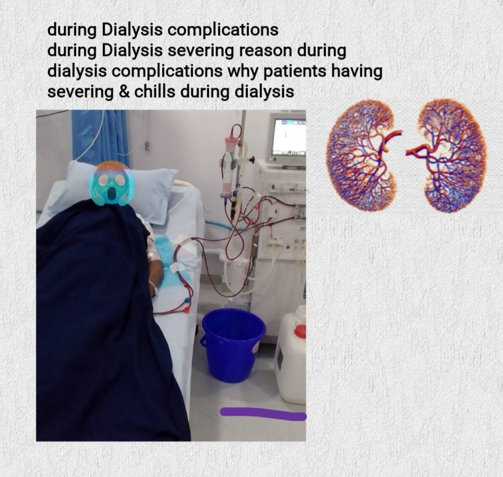 what is Dialysis in medical