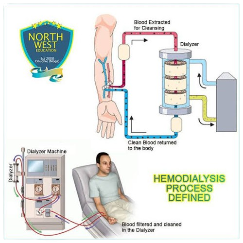 dialysis complications