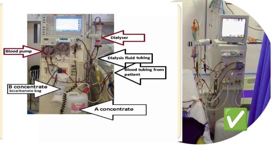 What is Dialysis