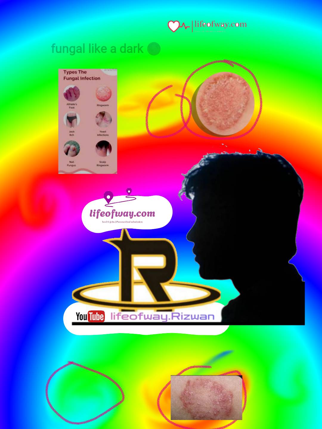 sketch-1726176102984 HOW TO REMOVE FUNGAL INFECTION PERMANENT
