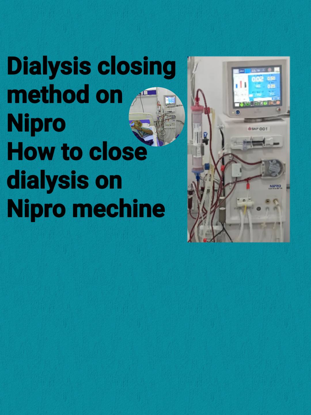 sketch-1746039696105 hemodialysis Adequacy